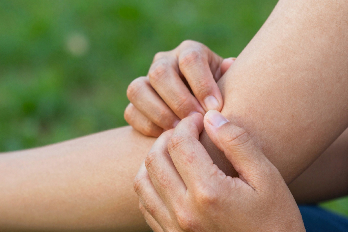 Prurito cronico e dermatite: scoperto il meccanismo che informa il cervello a smettere di grattarsi